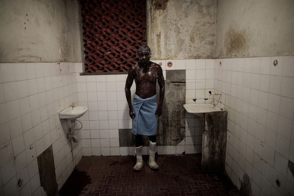 Ein an Lepra erkrankter Mann steht eingeseift und mit einem blauen Handtuch um die Hüften in einem heruntergekommenen Badezimmer. Die Wände sind von Schimmel befallen, die sanitären Anlagen in miserablem Zustand. 