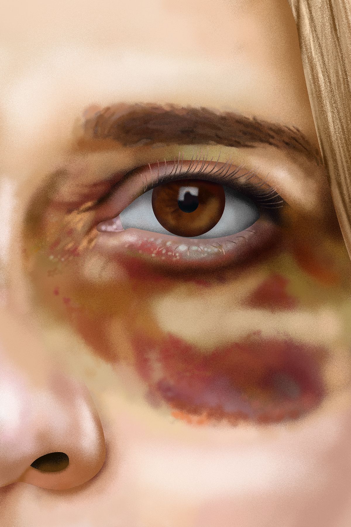 Femizide: Die Hilfe endet an der Kantonsgrenze